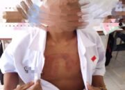 Kepsek SRMA 40 Ambon Diduga Tutupi Kasus Penyetrikaan Siswa oleh Petugas Kemensos