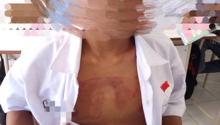 Kepsek SRMA 40 Ambon Diduga Tutupi Kasus Penyetrikaan Siswa oleh Petugas Kemensos